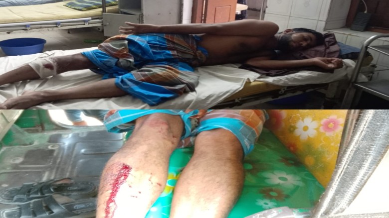 কচুয়ায় যুবদল নেতা আলমগীর হোসেনের উপর হামলা, নগদ টাকা ছিনতাই 